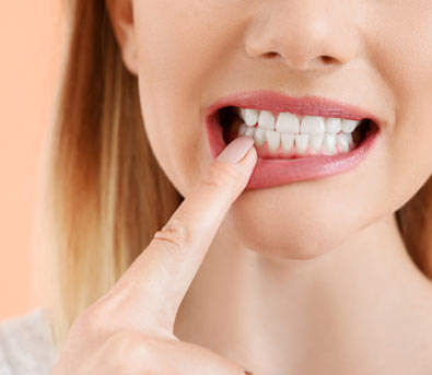 Belles dents traitement gingivectomie