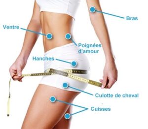 Liposuccion complète 